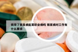 我得了銀屑病能算職業(yè)病嗎 銀屑病對工作有什么要求