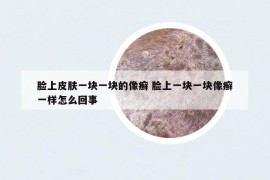 臉上皮膚一塊一塊的像癬 臉上一塊一塊像癬一樣怎么回事