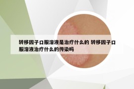 轉(zhuǎn)移因子口服溶液是治療什么的 轉(zhuǎn)移因子口服溶液治療什么的傳染嗎