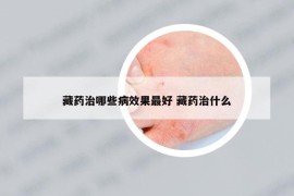 藏藥治哪些病效果最好 藏藥治什么