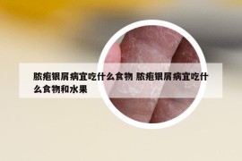 膿皰銀屑病宜吃什么食物 膿皰銀屑病宜吃什么食物和水果