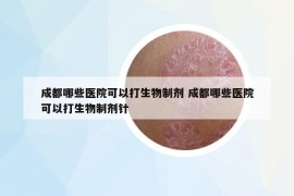 成都哪些醫(yī)院可以打生物制劑 成都哪些醫(yī)院可以打生物制劑針