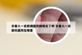 長春八一皮膚病醫(yī)院搬哪去了啊 長春八一皮膚科醫(yī)院在哪里