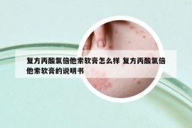 復(fù)方丙酸氯倍他索軟膏怎么樣 復(fù)方丙酸氯倍他索軟膏的說明書