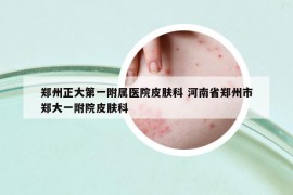 鄭州正大第一附屬醫(yī)院皮膚科 河南省鄭州市鄭大一附院皮膚科