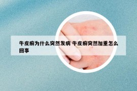 牛皮癬為什么突然發(fā)病 牛皮癬突然加重怎么回事
