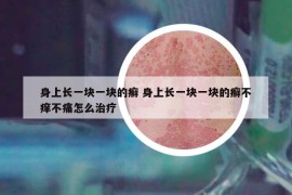 身上長一塊一塊的癬 身上長一塊一塊的癬不癢不痛怎么治療