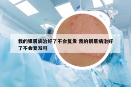 我的銀屑病治好了不會復(fù)發(fā) 我的銀屑病治好了不會復(fù)發(fā)嗎