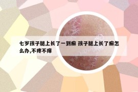 七歲孩子腿上長了一到癬 孩子腿上長了癬怎么辦,不疼不癢