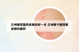 蘭州哪家醫(yī)院皮膚科好一點 蘭州哪個醫(yī)院看皮膚科最好
