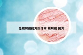 患銀屑病的外國作家 銀屑病 國外