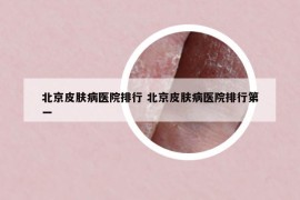 北京皮膚病醫(yī)院排行 北京皮膚病醫(yī)院排行第一