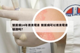 銀屑病14年用青霉素 銀屑病可以用青霉素輸液嗎?