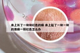 身上長了一塊塊紅色的癬 身上起了一塊一塊的像癬一樣紅色怎么辦