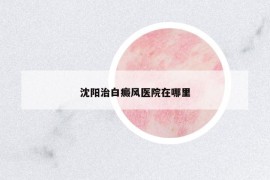 沈陽(yáng)治白癜風(fēng)醫(yī)院在哪里