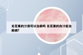 無(wú)花果的汁液可以治癬嗎 無(wú)花果的白汁能治癬病?