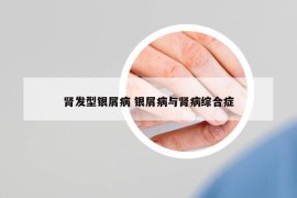 腎發(fā)型銀屑病 銀屑病與腎病綜合癥