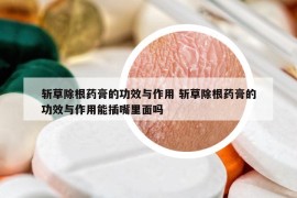 斬草除根藥膏的功效與作用 斬草除根藥膏的功效與作用能插嘴里面嗎