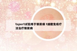 tsport試驗用于銀屑病 t細胞免疫療法治療銀屑病