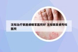沈陽治療銀翹病哪家醫(yī)院好 沈陽銀屑病專科醫(yī)院