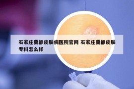 石家莊冀都皮膚病醫(yī)院官網 石家莊冀都皮膚?？圃趺礃? /></a>		
		</figure>

		<header class=