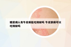 糖尿病人有牛皮癬能吃辣椒嗎 牛皮膚癬可以吃辣椒嗎