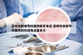 昆明皮膚病?？漆t(yī)院聯(lián)系電話 昆明市皮膚?？漆t(yī)院的熱線電話是多少