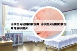 濕疹圖片初期癥狀圖片 濕疹圖片初期癥狀圖片蕁麻疹圖片