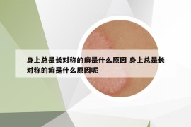 身上總是長(zhǎng)對(duì)稱的癬是什么原因 身上總是長(zhǎng)對(duì)稱的癬是什么原因呢