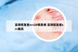 宮頸癌復(fù)查scc20銀屑病 宮頸癌復(fù)查scc偏高
