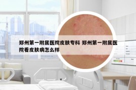 鄭州第一附屬醫(yī)院皮膚?？?鄭州第一附屬醫(yī)院看皮膚病怎么樣