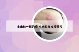 小米粒一樣的癬 小米粒樣皮疹圖片