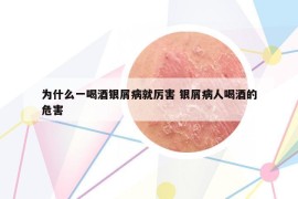 為什么一喝酒銀屑病就厲害 銀屑病人喝酒的危害