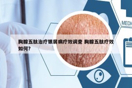 胸腺五肽治療銀屑病療效調(diào)查 胸腺五肽療效如何?
