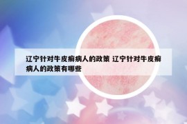 遼寧針對(duì)牛皮癬病人的政策 遼寧針對(duì)牛皮癬病人的政策有哪些