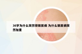 30歲為什么突然得銀屑病 為什么銀屑病突然加重
