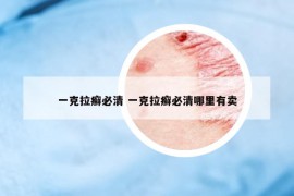 一克拉癬必清 一克拉癬必清哪里有賣