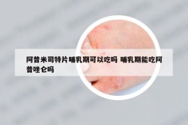 阿普米司特片哺乳期可以吃嗎 哺乳期能吃阿普唑侖嗎