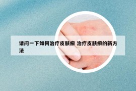 請問一下如何治療皮膚癬 治療皮膚癬的新方法