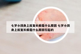 七歲小孩身上反復(fù)長癬是什么原因 七歲小孩身上反復(fù)長癬是什么原因引起的