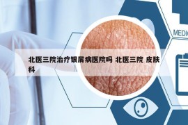 北醫(yī)三院治療銀屑病醫(yī)院?jiǎn)?北醫(yī)三院 皮膚科