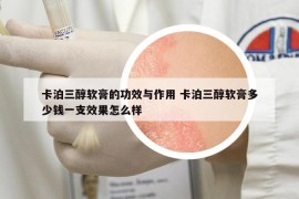 卡泊三醇軟膏的功效與作用 卡泊三醇軟膏多少錢一支效果怎么樣