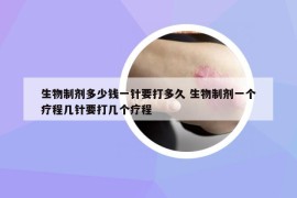生物制劑多少錢一針要打多久 生物制劑一個療程幾針要打幾個療程