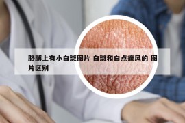 胳膊上有小白斑圖片 白斑和白點癲風的 圖片區(qū)別