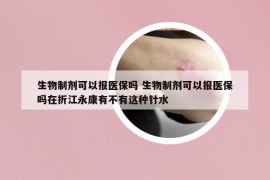 生物制劑可以報醫(yī)保嗎 生物制劑可以報醫(yī)保嗎在折江永康有不有這種針水