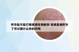懷孕能不能打銀屑病生物制劑 有銀屑病懷孕了可以摸什么樣的藥物
