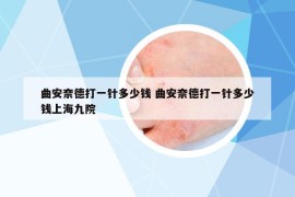 曲安奈德打一針多少錢 曲安奈德打一針多少錢上海九院