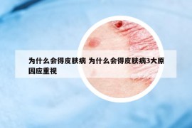 為什么會得皮膚病 為什么會得皮膚病3大原因應(yīng)重視
