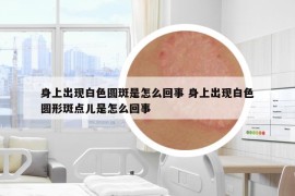身上出現(xiàn)白色圓斑是怎么回事 身上出現(xiàn)白色圓形斑點(diǎn)兒是怎么回事