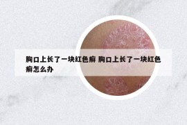 胸口上長了一塊紅色癬 胸口上長了一塊紅色癬怎么辦